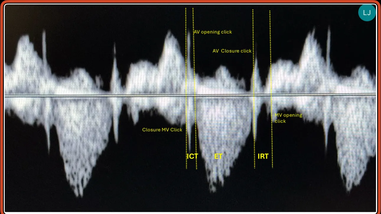 Tei Normal Courses | Mastering the Fetal Tei Index: A Comprehensive Ultrasound ...